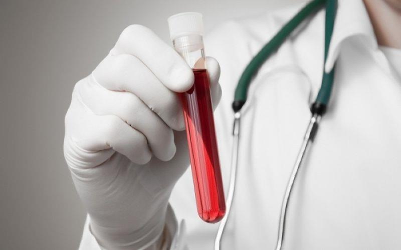 Χαμηλά αιμοπετάλια: Με ποιες παθήσεις συνδέονται